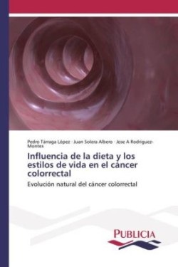 Influencia de la dieta y los estilos de vida en el cáncer colorrectal