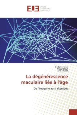 La dégénérescence maculaire liée à l'âge