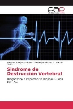 Sindrome de Destrucción Vertebral