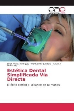 Estética Dental Simplificada Vía Directa