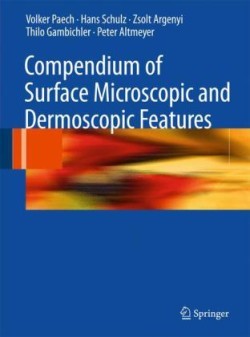 Compendium of Surface Microscopic and Dermoscopic Features