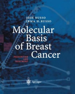 Molecular Basis of Breast Cancer