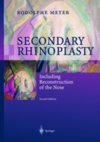 Secondary Rhinoplasty