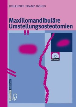 Maxillomandibuläre Umstellungsosteotomien