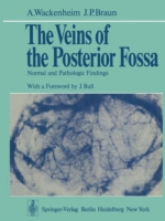 Veins of the Posterior Fossa