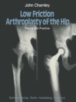Low Friction Arthroplasty of the Hip