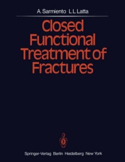 Closed Functional Treatment of Fractures