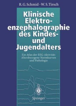 Klinische Elektroenzephalographie des Kindes- und Jugendalters