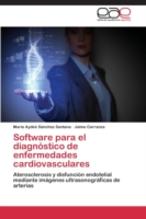 Software para el diagnóstico de enfermedades cardiovasculares