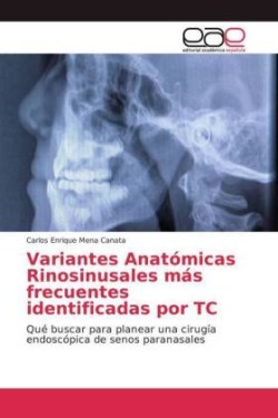 Variantes Anatómicas Rinosinusales más frecuentes identificadas por TC