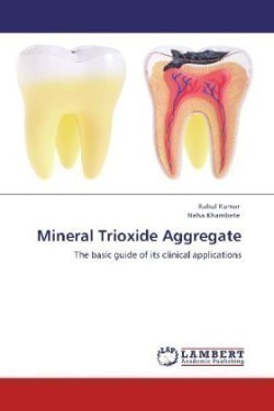 Mineral Trioxide Aggregate