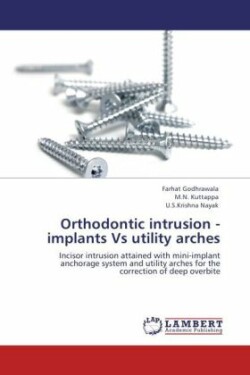 Orthodontic intrusion - implants Vs utility arches