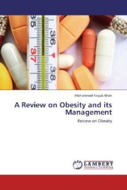 Review on Obesity and Its Management