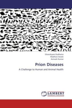 Prion Diseases