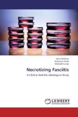 Necrotizing Fasciitis