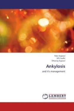 Ankylosis