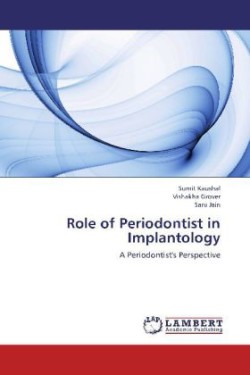 Role of Periodontist in Implantology