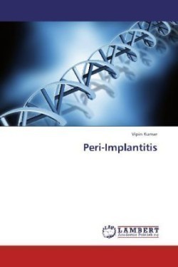 Peri-Implantitis