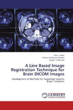 Line Based Image Registration Technique for Brain Dicom Images