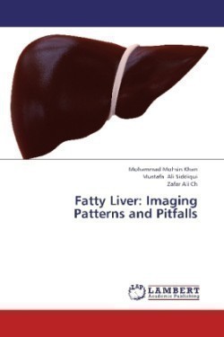 Fatty Liver