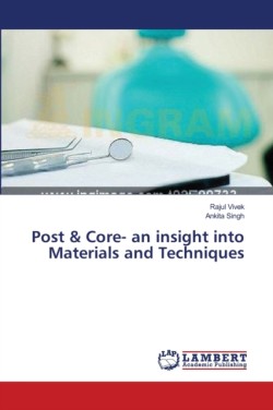 Post & Core- an insight into Materials and Techniques