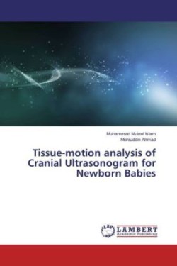 Tissue-motion analysis of Cranial Ultrasonogram for Newborn Babies