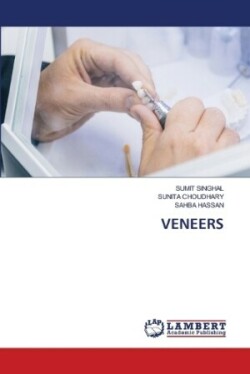 Veneers