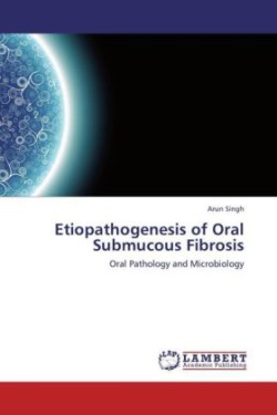 Etiopathogenesis of Oral Submucous Fibrosis