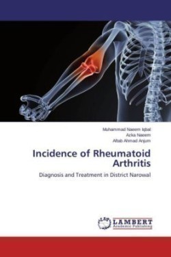 Incidence of Rheumatoid Arthritis