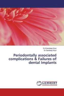 Periodontally associated complications & Failures of dental Implants