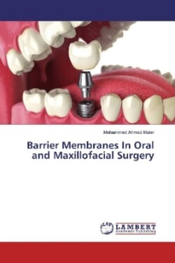 Barrier Membranes In Oral and Maxillofacial Surgery