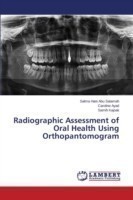 Radiographic Assessment of Oral Health Using Orthopantomogram