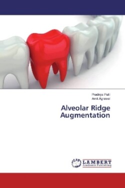 Alveolar Ridge Augmentation