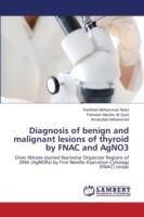 Diagnosis of benign and malignant lesions of thyroid by FNAC and AgNO3