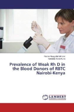 Prevalence of Weak Rh D in the Blood Donors of RBTC Nairobi-Kenya