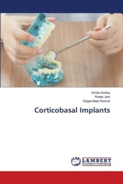 Corticobasal Implants