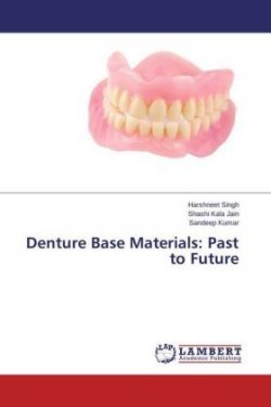 Denture Base Materials