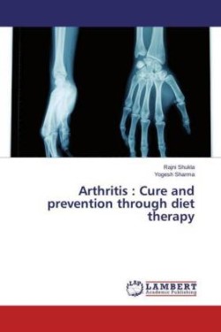 Arthritis