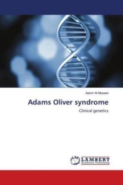 Adams Oliver syndrome