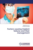 Factors causing Implant failures and their management