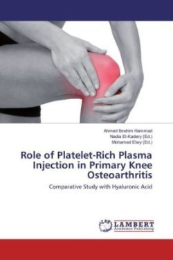 Role of Platelet-Rich Plasma Injection in Primary Knee Osteoarthritis