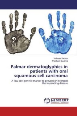 Palmar dermatoglyphics in patients with oral squamous cell carcinoma