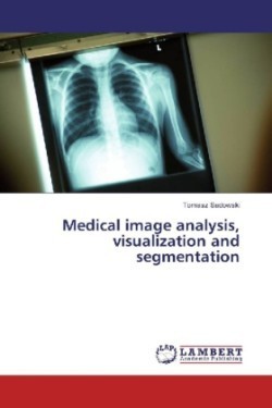 Medical image analysis, visualization and segmentation