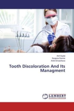 Tooth Discoloration And Its Managment