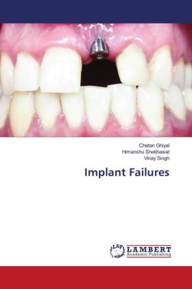 Implant Failures