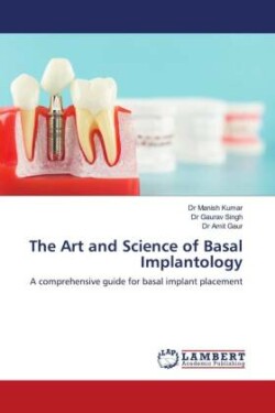 Art and Science of Basal Implantology