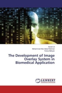 The Development of Image Overlay System in Biomedical Application