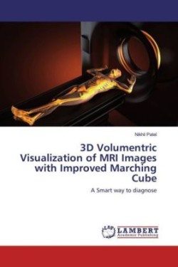 3D Volumentric Visualization of MRI Images with Improved Marching Cube