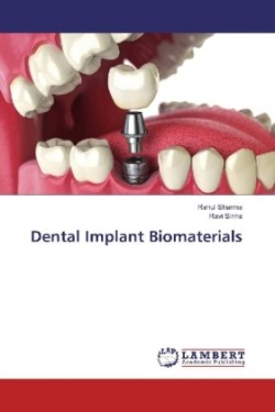 Dental Implant Biomaterials