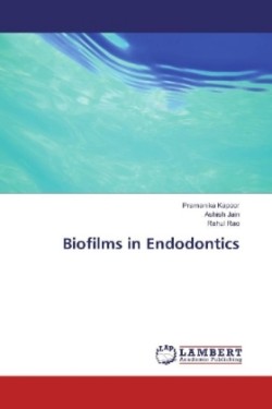 Biofilms in Endodontics